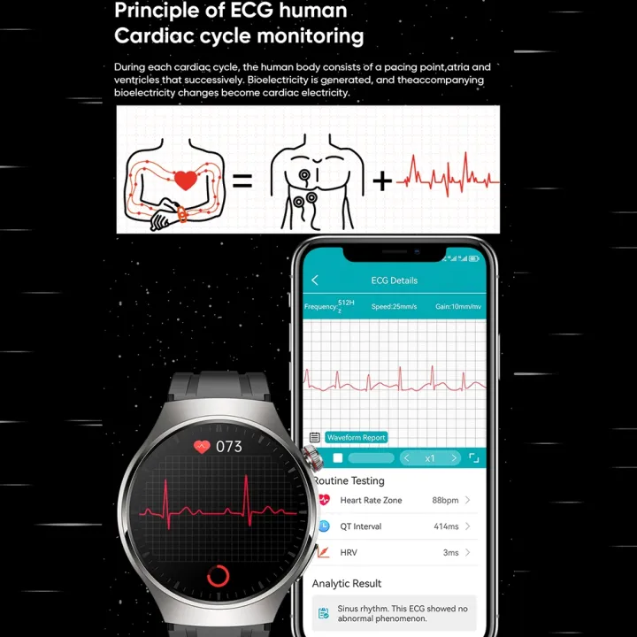 %EF%BC%88COD%20Available)MT200%201.43%20inch%20AMOLED%20IP67%20Call%20Watch,%20Support%20ECG/Body%20Temperature/Blood%20Glucose%20Monitoring%20-%20Image%205