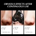 Oil-control Blackhead Remover Mask Nose Black Dots Acne Deep Cleansing Beauty Korean Skin Care Cosmetics for Women Men Face Mask.