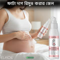 EELHOE Scar Removal Cream Gel Burn Surgical Scar Cesarean Scar Repairing Stretch Marks Pigmentation Corrector. 