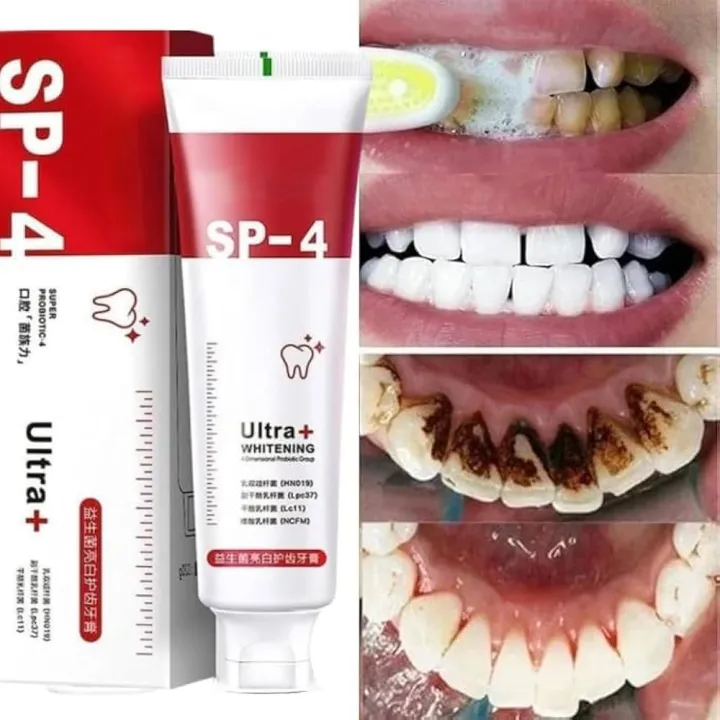 SP%204%20probiotic%20whitening%20toothpaste,%20Ultra%20Brightening%20Toothpaste,%20Advanced%20Whitening%20Formula%20for%20Stain%20Removal%20and%20Enamel%20Protection%20-%20Image%203