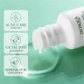 35ml Anti-acne Essence Salicylic Acid Oil Control Moisturizing And Cleansing Skin Skin Care Solution For Shrinking Pores. 