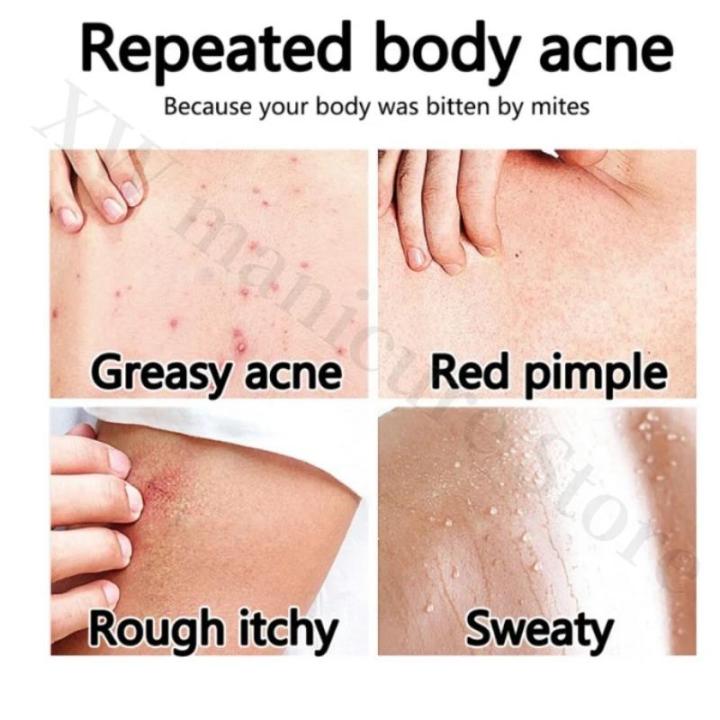 Vaseline%20Niacinamide%20Body%20Lotion%20Relieves%20Dry%20and%20Dehydrated%20Skin%20Exfoliates%20and%20Brightens%20Skin%20Tone%20Hydrating%20Body%20Lotion%20-%20Image%205