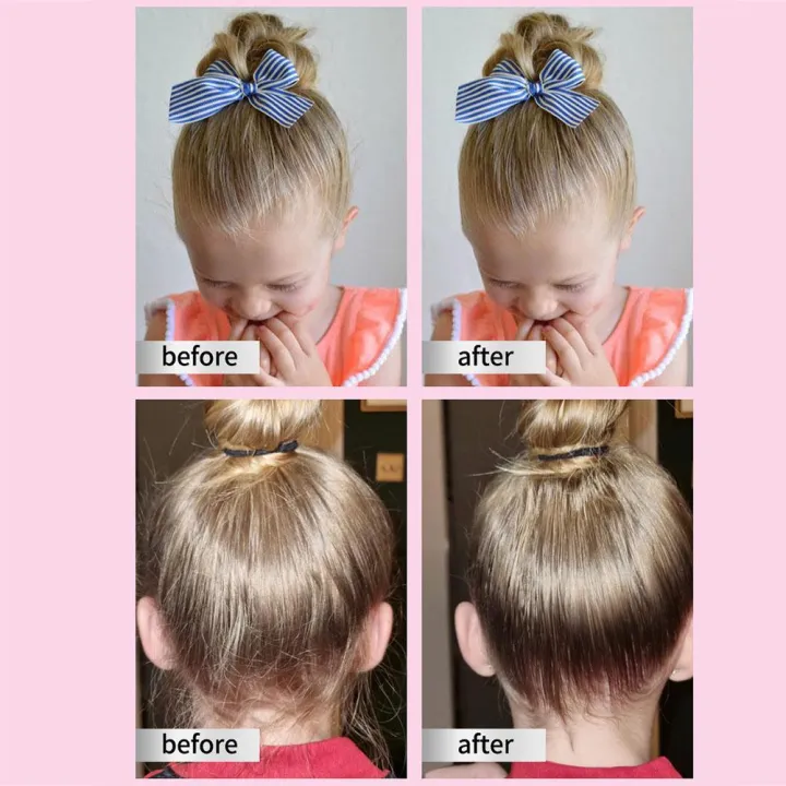 Hair%20Wax%20Gel%20Cream%20For%20children%20Hair%20Wax%20Stick%20Gel%20Cream%20Non-Greasy%20Style%20Hair%20Wax%20Cream%20For%20girls%20Boys%20Broken%20Hair%20Artifac%20G3P8%20-%20Image%205