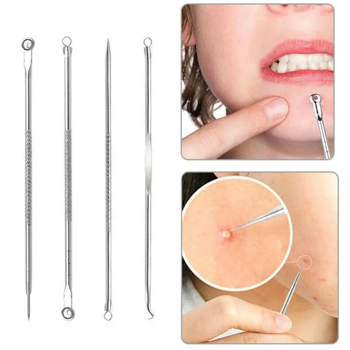Professional%20Pimple%20Popper%20Tool%20Kit%20-%20With%20Comedone%20Extractor,%20Milia%20Removal%20Tool,%20Blackhead%20Tweezers,%20and%20Whitehead%20Remover%20Tool,%20Spot%20Treatment%20Acne%20Set%20-%20Image%202