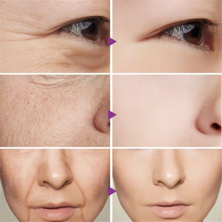 Wrinkle%20Remove%20Dragon%20Blood%20Cream%20Whitening%20Moisturizing%20Repair%20Cosmetics%20Anti-aging%20Women%20Face%20Beauty%20Nourish%20Skin%20Care%20Product%20-%20Image%202