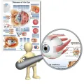 WANGART Poster Diseases of the Eye Chart Posters Refractiv Canvas print Wall Pictures for Medical Education Home Decor. 