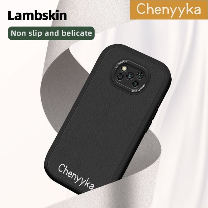 Chenyyka%20For%20Xiaomi%20POCO%20X3%20Xiaomi%20POCO%20X3%20NFC%20Xiaomi%20POCO%20X3%20Pro%20Case%20New%20Design%20Leather%20Soft%20Back%20Cover%20Camera%20Thin%20Patten%20Protect%20Cases%20Shockproof%20Casing%20-%20Image%207