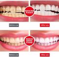 Yayashi SP-4 Ultra Whitening Toothpaste 120gm. 