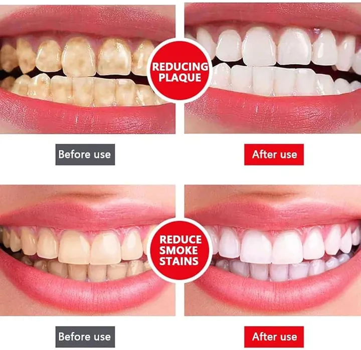 Yayashi%20SP-4%20Ultra%20Whitening%20Toothpaste%20120gm%20-%20Image%203