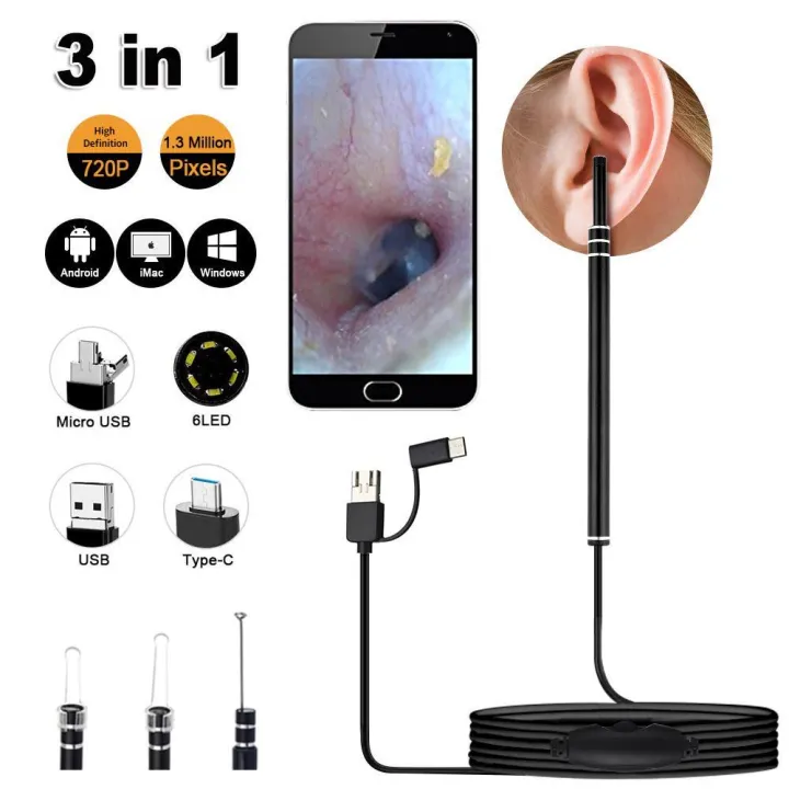 USB%20Otoscope-Ear%20Endoscope%20Diameter%20Visu%20Waterproof%20HD%20Ear%20Camera%20with%20Ear%20Tool%20and%206%20Adjustable%20LED%20Lights%20for%20-Android%20and%20Windows%20-%20Image%203