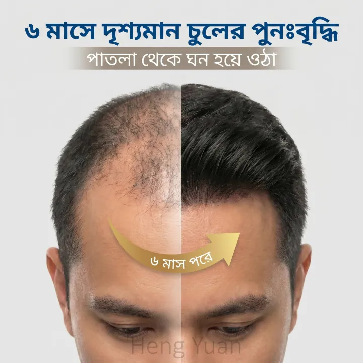 Kirkland%20Signature%20Minoxidil%205%25%20Topical%20Solution%20Extra%20Strength%20Beard%20&%20Hair%20Regrowth%20Treatment%2060ml%201%20Month%20Supply%20-%20100%25%20Original%20-%20MNXMS%20-%20Image%204