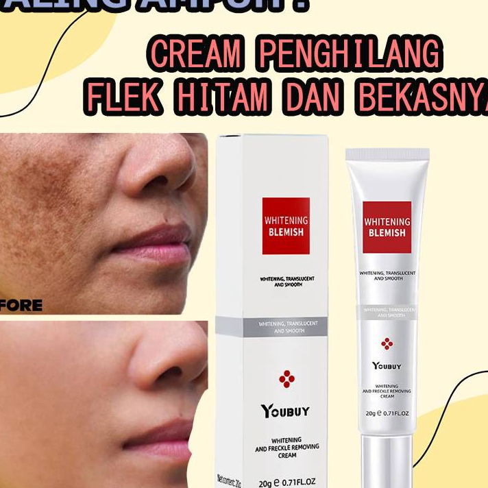 YOUBUY%20Whitening%20Blemish%2020g%20Best%20Selling%20Whitening%20Moisturizing%20Anti%20Aging%20Freckle%20Removing%20Face%20Cream%20-%20Image%202