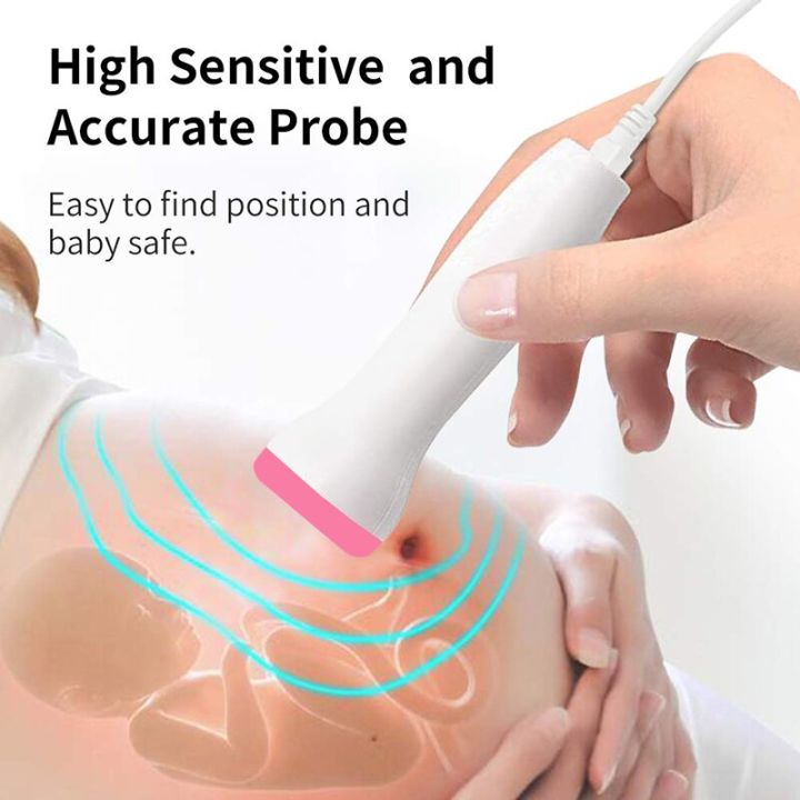 Fetal%20Doppler%202.5M%20Fetal%20Heart%20monitor%20Fetal%20Preference%20Fetal%20state%20Pregnant%20woman%20guardianship%20baby%2012%20weeks%20later%20-%20Image%205