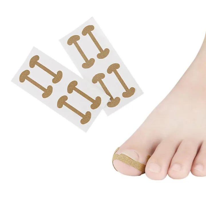 1/5pc%20Toe%20sticker%20Nail%20Strips%20Anti-roll%20Nail%20Glue%20Toe%20Inlay%20Nail%20Corrector%20Stickers%20Nail%20Patch%20Ingrown%20Toenail%20Correction%20Tool%20-%20Image%204