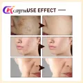 ROREC White Rice Serum Best For Pores & Moisturizing - 15ml. 