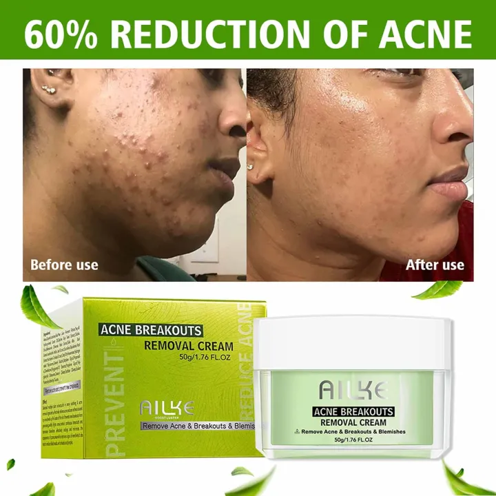 AILKE%20Salicylic%20Acid%20Organic%20Anti-Acne%20Cleansing%20Face%20Care,%20Smooth,%20Clear%20Acne%20Free%20Skin,%20Reduce%20Acne%20Scar,%20Spots,%20Breakout%20-%20Image%204