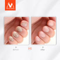 MeiYanQiong Lavender Fungal Nail Treatment Essential Oil Nail Art & Tools Promote Nails Grow Healthy Nail Treatment Onychomycosis Foot Care. 