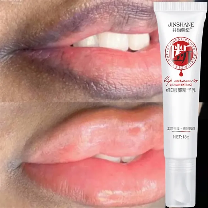 2024 New Lips Pink Cream Fresh Bleaching Treatment Remove Dark Smoke Lips Lip Balm Whitening Moisturizer Nourish Essence Dilute Melanin For Women