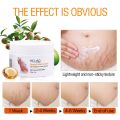 MELAO Women Remove Pregnancy Scars Acne Cream Stretch Marks Treatment Maternity Repair Anti-Aging  Body Creams-120gm. 