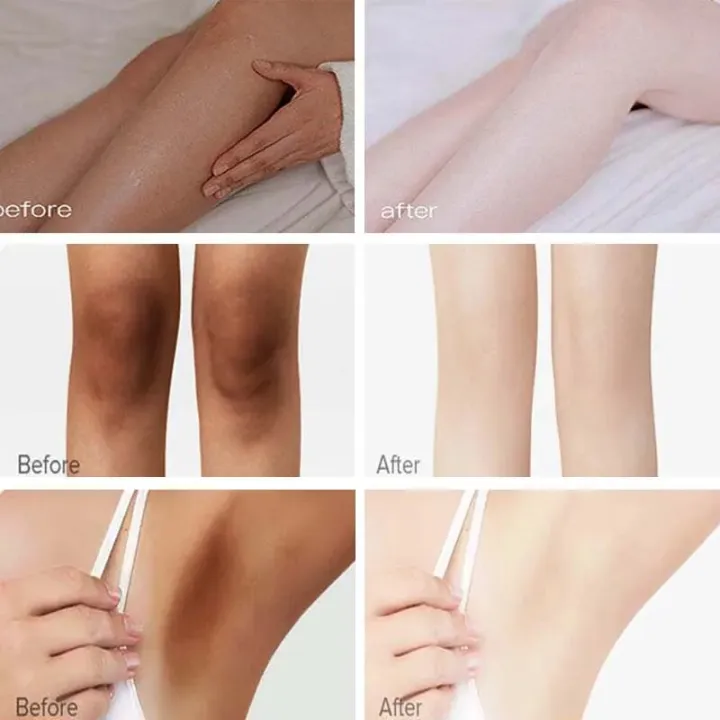 Intimate%20Area%20Whitening%20Cream%20Pink%20Body%20Serum%20Lighten%20Melanin%20Underarms%20Hips%20Inner%20Thighs%20Brightening%20Repair%20Private%20Part%20Care%20-%20Image%202