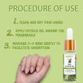 Nail Cuticle Oil for Nails Oil Treatment for Damaged Nails Cuticle Repair Jojoba Oil Nails Care Strengthener Nail Oil Cuticle. 