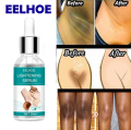 Retinol EELHOE Dark Parts Dark Underarm and Bikini Areas Whitening Anti Wrinkle Moisturizing Makes Your Private area Clean And White. 