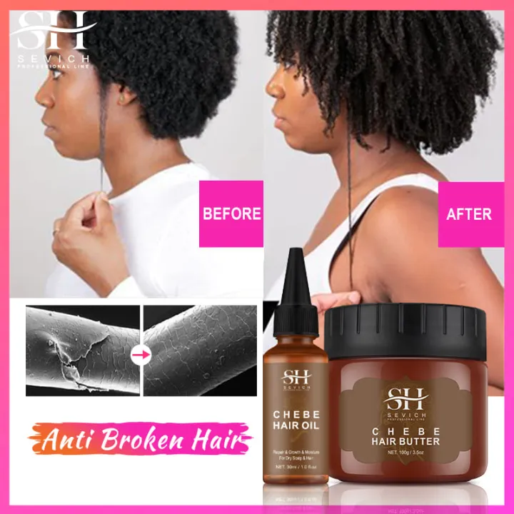 Fast%20Hair%20Growth%20Oil%20African%20Crazy%20Traction%20Alopecia%20Chebe%20Hair%20Mask%20Anti%20Hair%20Break%20Hair%20Strengthener%20Hair%20Loss%20Treatment%20Spray%20-%20Image%204