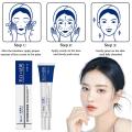 Whitening Freckle Cream Effective Remove Melasma Dark Spots Cream Fade Moisturize Brighten Smooth Beauty Face Care 2024.