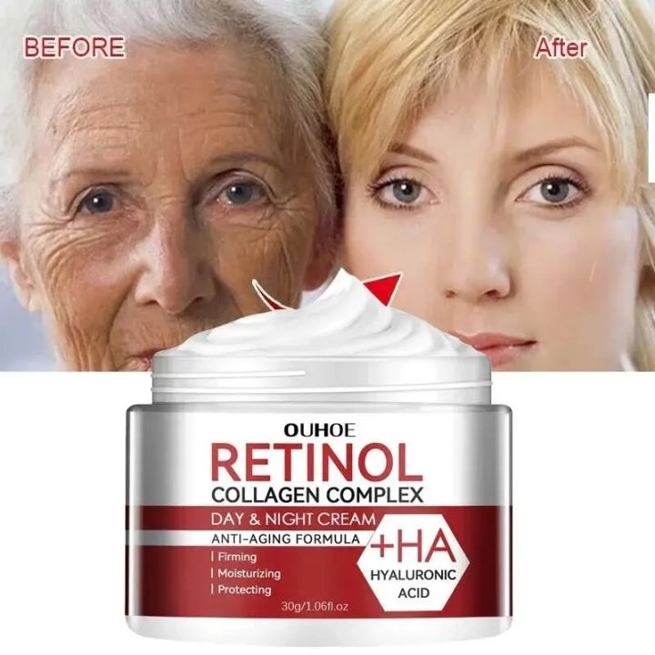 30g%20Retinol%20Remove%20Wrinkles%20Face%20Cream%20Lifting%20Anti-Aging%20Fine%20Lines%20Moisturizing%20Brighten%20Skin%20Care%20Korean%20Cosmetics%202024%20New%20-%20Image%203