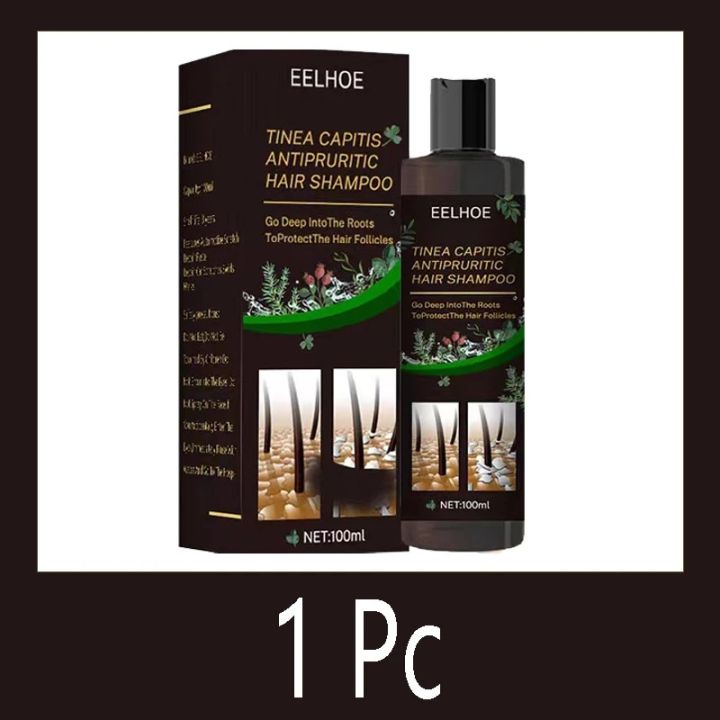 Treatment%20Of%20Psoriatic%20Seborrheic%20Dermatitis%20With%20Anti%20Tinea%20Capitis%20And%20Anti%20Itching%20Shampoo%20Anti%20Dandruff%20And%20Oil%20Control%20Hair%20-%20Image%207