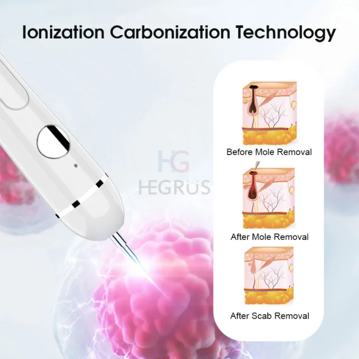(NEW)%20Face%20Mole%20Removal%20Pen%20Spots%20Tattoo%20Freckle%20Removal%20Pen%20Skin%20Tag%20Remover%20LED%20Lighting%20Sweep%20Mole%20Removing%20Dark%20Spot%20Remover%20Skin%20Care%209%20Adjustable%20Modes%20Laser%20Mole%20Pen%20-%20Image%203