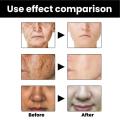 Melanin Correcting Facial Serum Dark Spot Corrector Remover Skin Care Moisturizing Repair Serum Hyaluronic Acid Vitamin C Serum. 