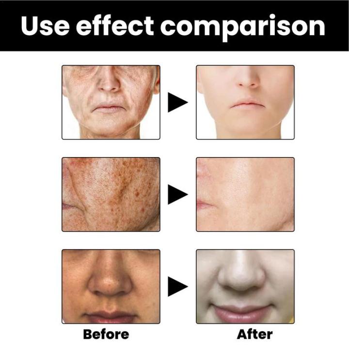 Melanin%20Correcting%20Facial%20Serum%20Dark%20Spot%20Corrector%20Remover%20Skin%20Care%20Moisturizing%20Repair%20Serum%20Hyaluronic%20Acid%20Vitamin%20C%20Serum%20-%20Image%204