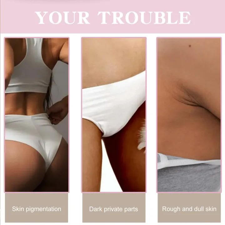 Body%20Whitening%20Cream%20Facial%20Legs%20Bikini%20Sensitive%20Areas%20Whitening%20Brighten%20Skin%20Colour%20Dark%20Spot%20Corrector%20For%20Intimate%20Areas%20-%20Image%205