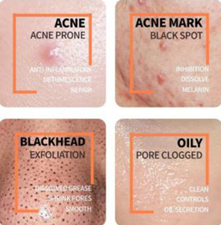 Salicylic%20Acid%202%25%20Solution%20serum%20(granted%20product%20)%20-%20Image%203