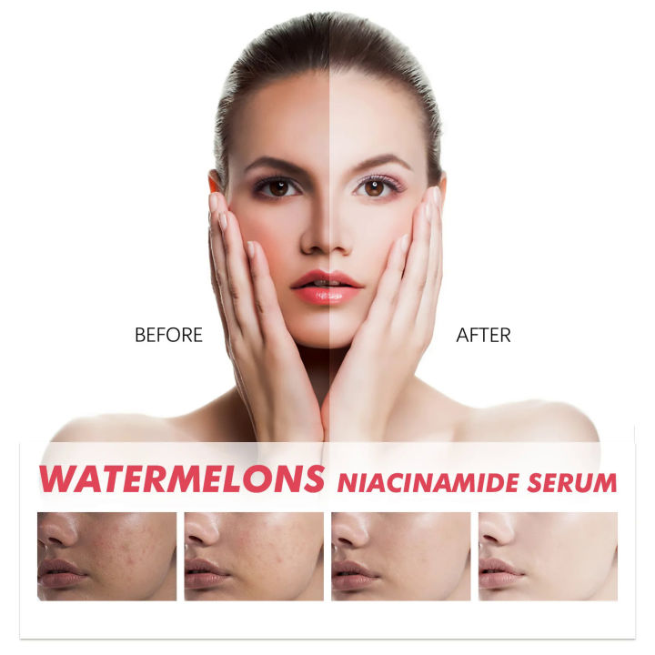 Watermelon%20Glow%20Niacinamide%20Dew%20Drops%20Serum%20Brightening%20Makeup%20Primer%20Cream%20Moisturizer%20Facial%20Serum%20Skincare%20Liquid%20Highlighter%20-%20Image%205