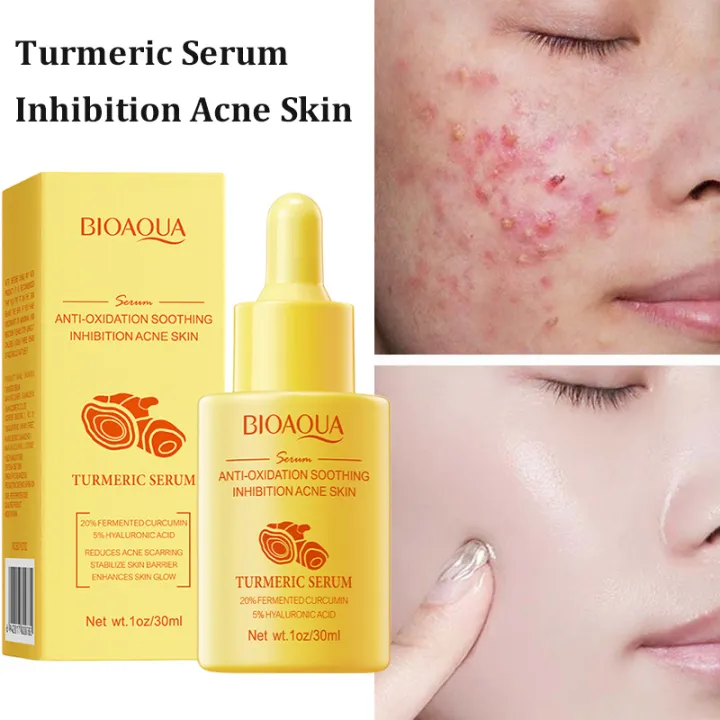 thumbnail image 2 of BIOAQUA TURMERIC SERUM ANTI-OXIDATION SOOTHING INHIBITION ACNE SKIN... 2 of 14