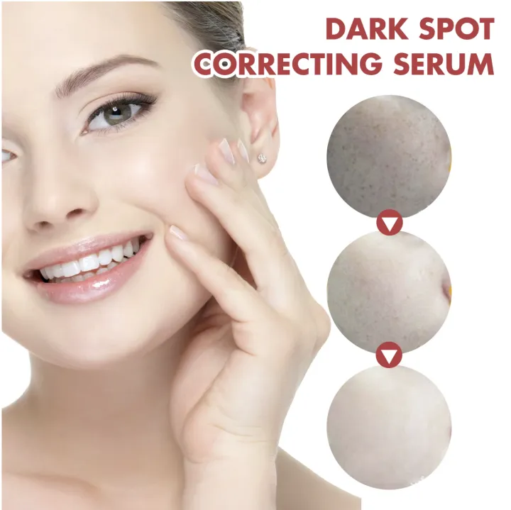 Hoygi%20Dark%20Spots%20Correcting%20Serum%20Niacinamide%2010%25%20+%20TXA%204%25%20+%20Arbutin,%20Reduces%20Dark%20Spots,%20Whitens%20&%20Brightens%20Skin%20-%20Image%207