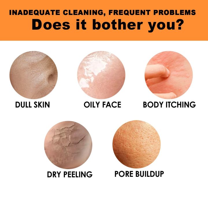 Whitening%20Soap%20for%20Dark%20Skin%20Bleaching%20Reduce%20Black%20Spots%20Melasma%20Deep%20Cleansing%20Moisturizing%20Lighten%20Vitamin%20C%20Brightening%20Soap%20-%20Image%206