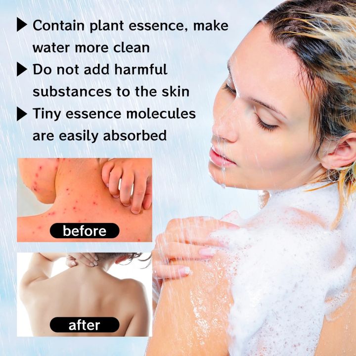 Anti%20Back%20Acne%20Soap%20Remove%20Pimple%20Oil%20Control%20Reduce%20Mite%20Anti%20Inflammation%20Deep%20Cleansing%20Acne%20Treatment%20Moisture%20Whiten%20Soap%20-%20Image%206