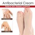 Psoriasis Treatment Cream Antibacterial Dermatitis Eczema Therapy Relieve Rash Urticaria Skin Herbal Skin Anti Itch Ointment 30g.