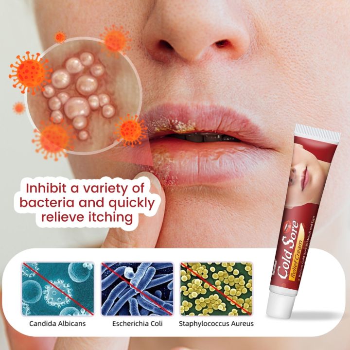 20g Cold Sores Lip Cream epair Cheilitis Lips erpes lceration Antibacterial Ointment oisturizing Lip alm