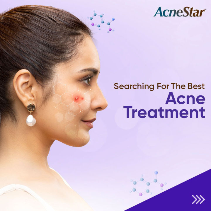 AcneStar%20Gel%2022g%20Clindamycin%20&%20Nicotinamide%20Gel%20%20%7C%20Made%20in%20INDIA%20-%20Image%205