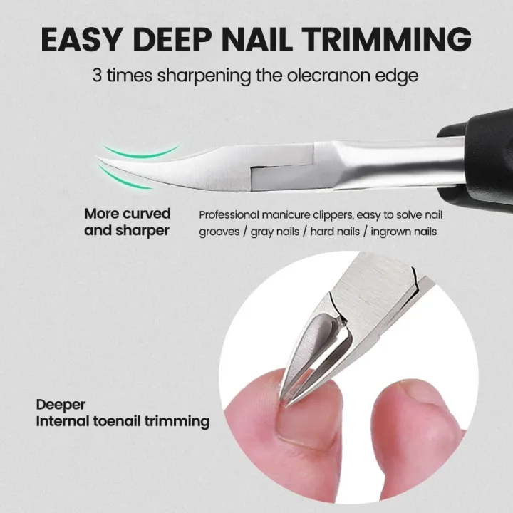 10PCS%20Ingrown%20Toenail%20Correction%20Tool%20Nail%20Treatment%20Toe%20Nail%20Sticker%20Foot%20Care%20Pedicure%20Foot%20Orthodontic%20Toe%20Thumb%20Nail%20Patches%20-%20Image%204