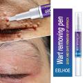 Beauty Health Skin Care Removal Of Warts Liquid Warts Remover Pen Removing Against Moles Anti Verruca Remedy. 