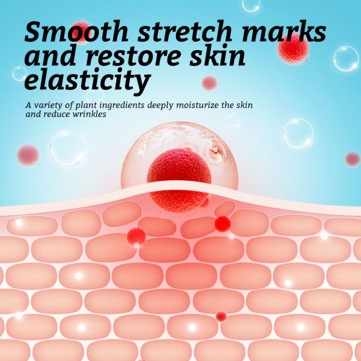 RtopR%20Mango%20Stretch%20Mark%20Cream%20Stretch%20Mark%20Repair%20Maternity%20Repair%20Cream%20Anti-Aging%20Anti-Wrinkle%20Firming%20Whitening%20Body%20Cream%2040g%20-%20Image%205