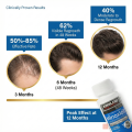 Kirkland Minoxidil 5% Topical Solution Extra Strength Hair Regrowth Treatment for Men Hair & Beard Drop + Derma Roller Free - (1 month supply) - MNXMC. 