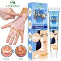 20g Herbal Extract Vitiligo Ointment Remove Ringworm White Spot Removal Skin White Spot Leukoplakia Disease Treatment Cream. 