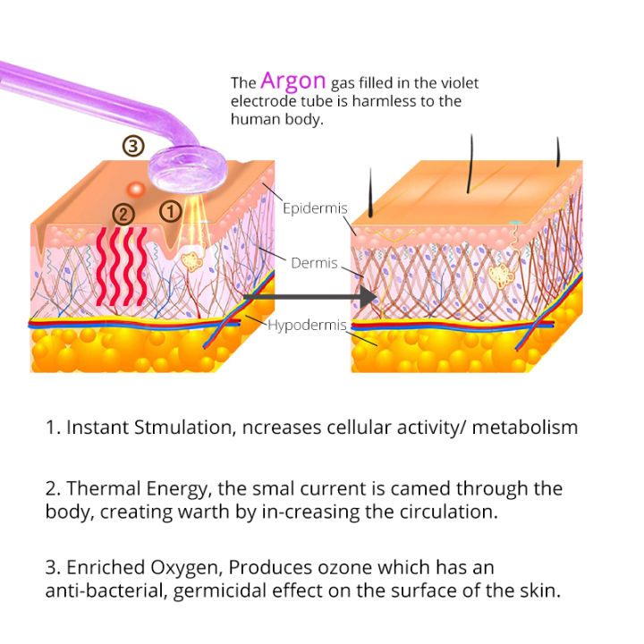 DARSONVAL%20Apparatus%20High%20Frequency%20Facial%20Machine%20Acne%20Tools%20Face%20Massager%20D'arsonval%20Skin%20Care%20Beauty%20Spa%20Darsonval%20For%20Hair%20-%20Image%203