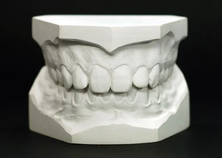 1Kg%20Dental%20Modeling%20Plaster%20Of%20Paris%20for%20Teeth%20model%20%7C%20Creative%20Design%20Make%20-%20Image%202
